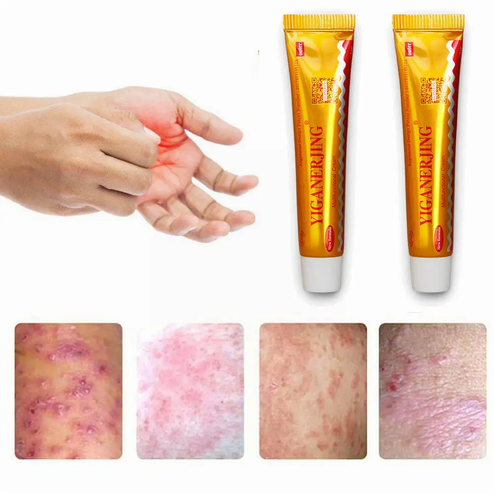 Skin Psoriasis Cream Dermatitis Eczematoid Eczema Ointment Treatment Psoriasis Cream Skin Care Cream
Skin Psoriasis Cream Dermatitis Eczematoid Eczema Ointment Treatment Psoriasis Cream Skin Care Cream