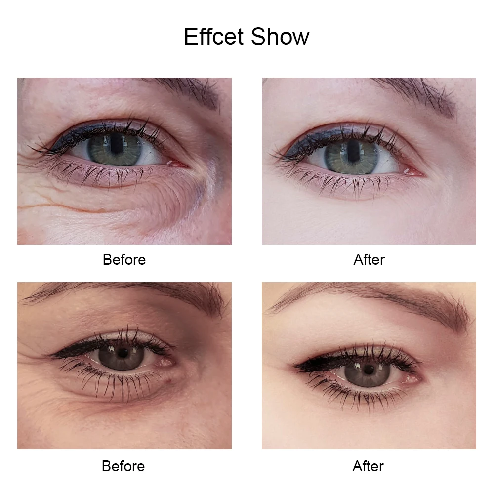 Blueberry Extract Eye Patch Face Care Hyaluronic Acid Eye Mask Remove Dark Circle Puffiness Ageless Lifting Firming Skin Care
Blueberry Extract Eye Patch Face Care Hyaluronic Acid Eye Mask Remove Dark Circle Puffiness Ageless Lifting Firming Skin Care