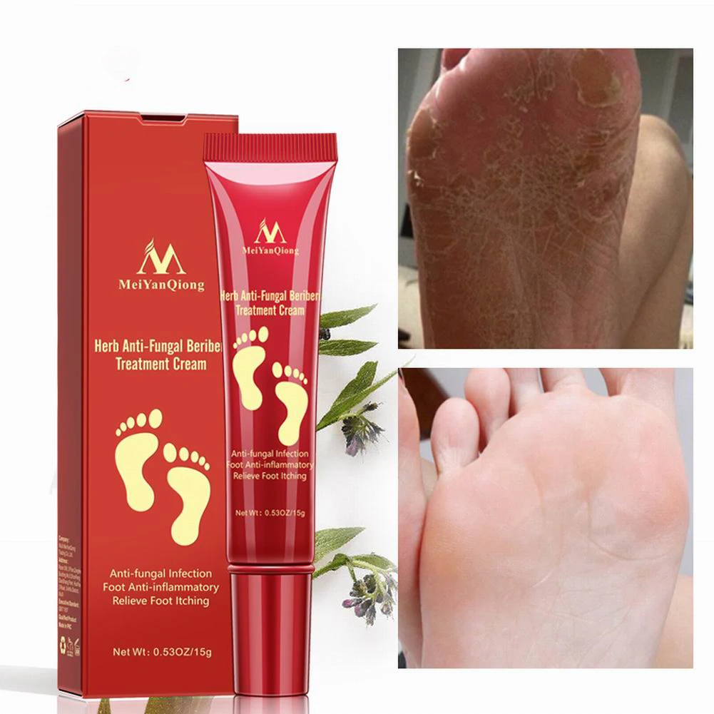 Foot Cream Herbal Anti Fungal Relieve Beriberi Foot Cream Skin Care Toe Treatment Anti Fungal Infection Foot Repair New Product
Foot Cream Herbal Anti Fungal Relieve Beriberi Foot Cream Skin Care Toe Treatment Anti Fungal Infection Foot Repair New Product