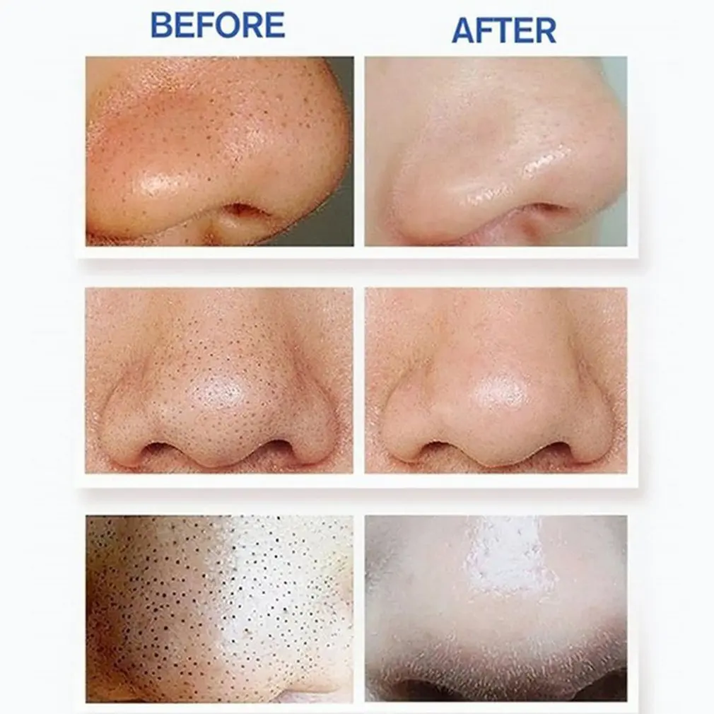New Portable Electric Suction Blackhead Acne Pore Cleanser Beauty Instrument Electric Blackhead Remover
New Portable Electric Suction Blackhead Acne Pore Cleanser Beauty Instrument Electric Blackhead Remover