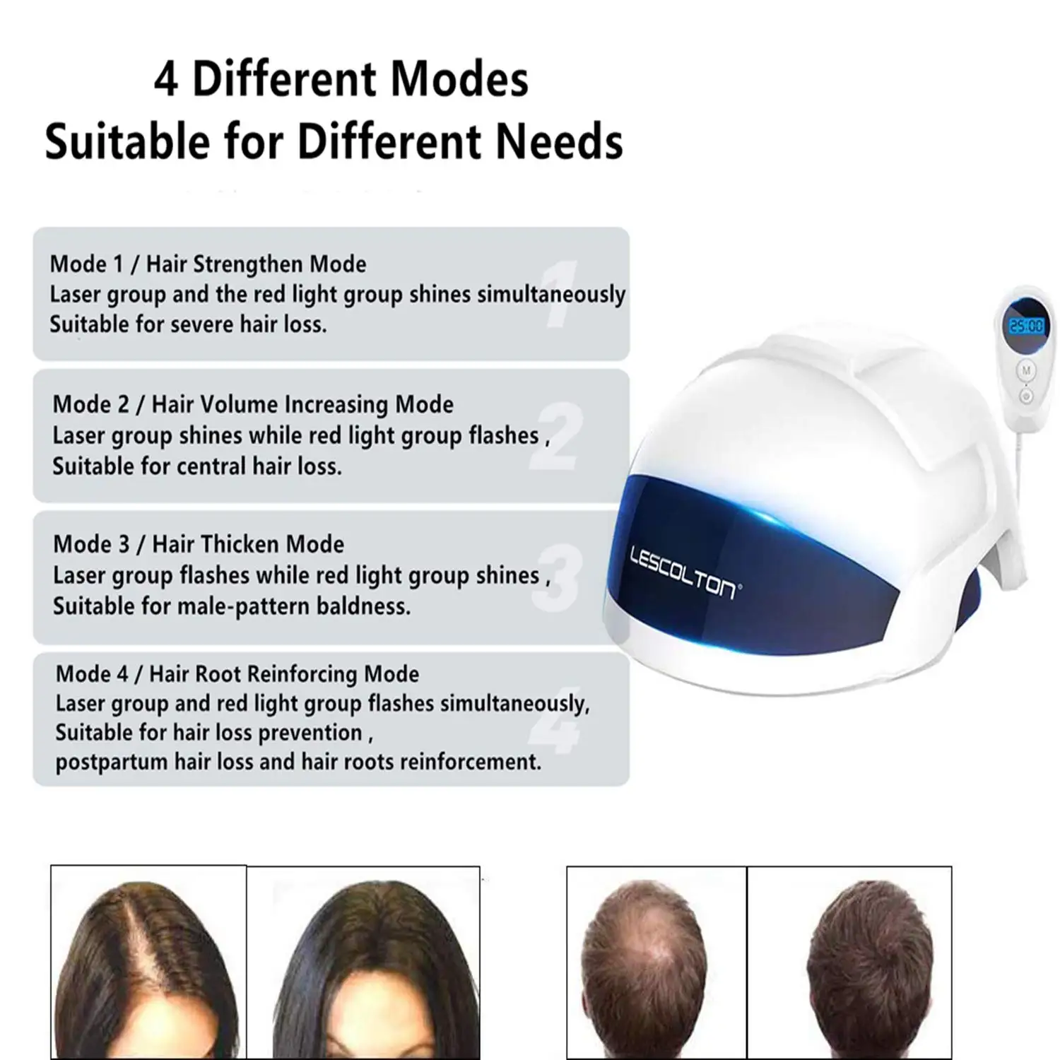 Laser Hair Growth Helmet Anti Hair Loss Cap Medical Hair Treatment Product for Men Women CE FCC LLLT Therapy Hair Restore Device
Laser Hair Growth Helmet Anti Hair Loss Cap Medical Hair Treatment Product for Men Women CE FCC LLLT Therapy Hair Restore Device