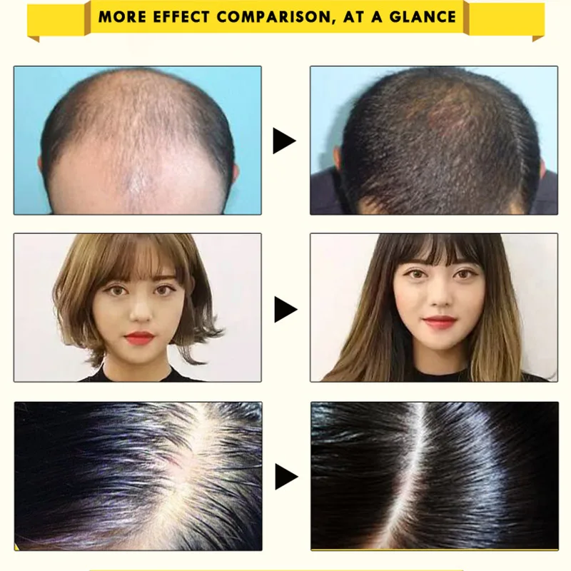 Hair Care Essential Oil Essence Nourishes 20ml Prevention Hair Loss For Repairing Damaged STTX889
Hair Care Essential Oil Essence Nourishes 20ml Prevention Hair Loss For Repairing Damaged STTX889