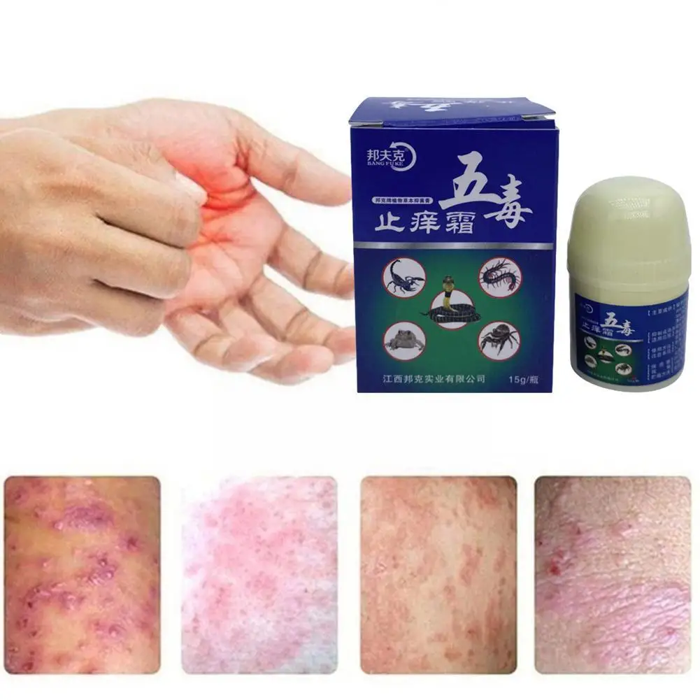 Five Toxin Anti-itch Cream Herbal Anti-bacterial Cream For External Use Ointment Of Anti-itch Ringworm Skin W8C1
Five Toxin Anti-itch Cream Herbal Anti-bacterial Cream For External Use Ointment Of Anti-itch Ringworm Skin W8C1