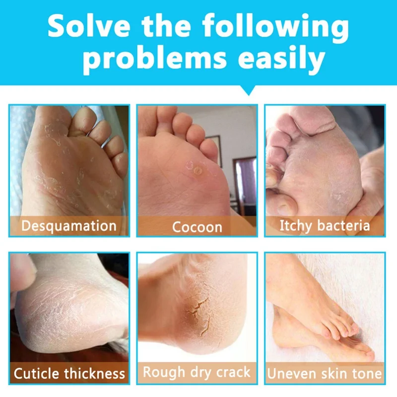 Hot Milk Exfoliating Foot Mask Moisturizing Remove Calluses Soften Skin Nourishing Feet Mask
Hot Milk Exfoliating Foot Mask Moisturizing Remove Calluses Soften Skin Nourishing Feet Mask