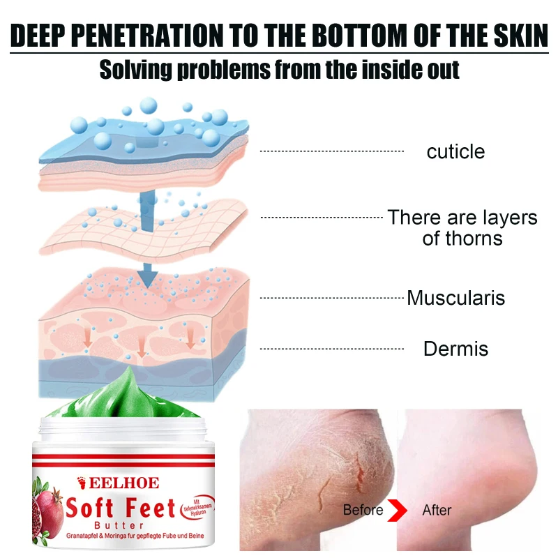 Eelhoe Repair Cream Anti Dry Skin Hand And Foot Crack Heel Chapped Peeling Foot Cream Repair Hand And Foot Peeling And Cracking
Eelhoe Repair Cream Anti Dry Skin Hand And Foot Crack Heel Chapped Peeling Foot Cream Repair Hand And Foot Peeling And Cracking