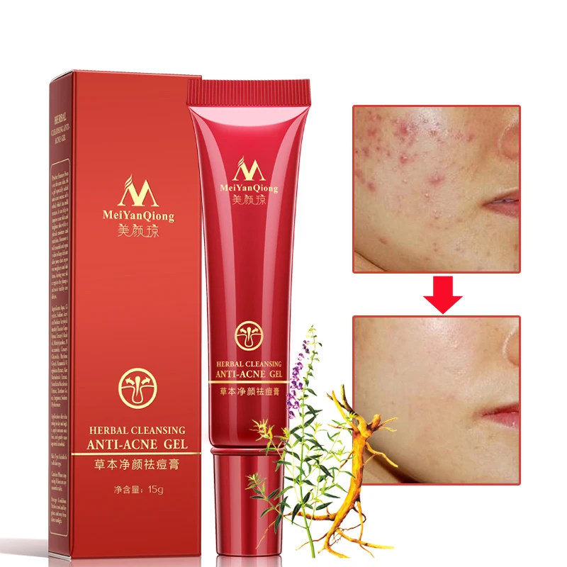 Herbaceous Cleansing Gel Face Anti acne treatment cream Herbal scar removal oily skin Acne Spots skin care face clean Health
Herbaceous Cleansing Gel Face Anti acne treatment cream Herbal scar removal oily skin Acne Spots skin care face clean Health