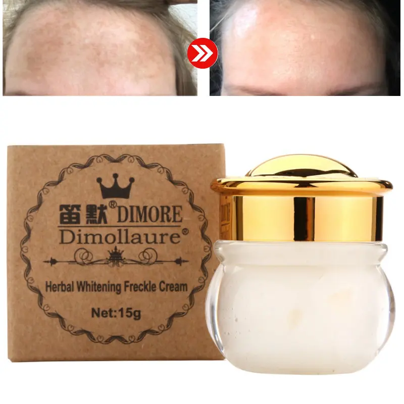 Dimollaure Strong effects whitening Freckle cream Moisturizing Remove melasma pigment Melanin Acne Spots cosmetics Skin Care
Dimollaure Strong effects whitening Freckle cream Moisturizing Remove melasma pigment Melanin Acne Spots cosmetics Skin Care