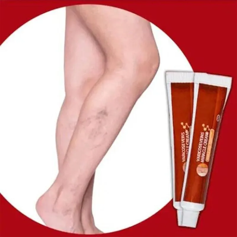20g Varicose Veins Ointment Varicosity Angiitis Removal Medical Plaster Legs Vein Vasculitis Phlebitis Spider Pain Relief Cream
20g Varicose Veins Ointment Varicosity Angiitis Removal Medical Plaster Legs Vein Vasculitis Phlebitis Spider Pain Relief Cream