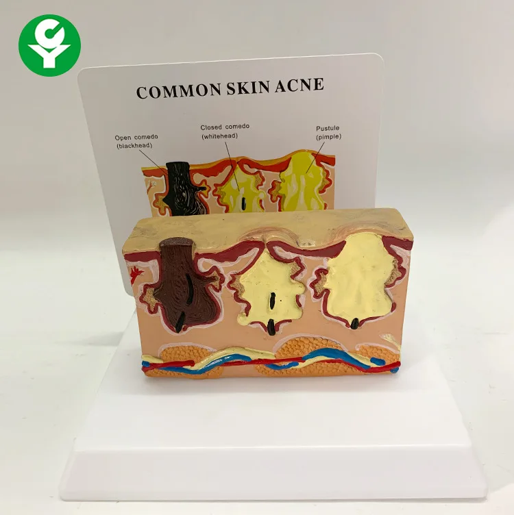 Увеличивающая кожу структура угрей, анатомическая модель ткани, иерархическая микропластиковая хирургия, швы, обучение красоте 
Увеличивающая кожу структура угрей, анатомическая модель ткани, иерархическая микропластиковая хирургия, швы, обучение красоте