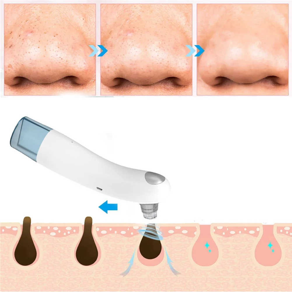 Black Spots Pore Cleaner Machine Facial Blackhead Remover Electric Acne Cleaner Blackhead Black Point Vacuum Cleaner Tool
Black Spots Pore Cleaner Machine Facial Blackhead Remover Electric Acne Cleaner Blackhead Black Point Vacuum Cleaner Tool