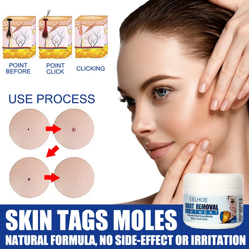 30g Warts Remover Ointment Herbal Extract Serum Mole Wart Pain Relief Antibacterial Cream Warts Treatment Skin Tag Removal Care
30g Warts Remover Ointment Herbal Extract Serum Mole Wart Pain Relief Antibacterial Cream Warts Treatment Skin Tag Removal Care