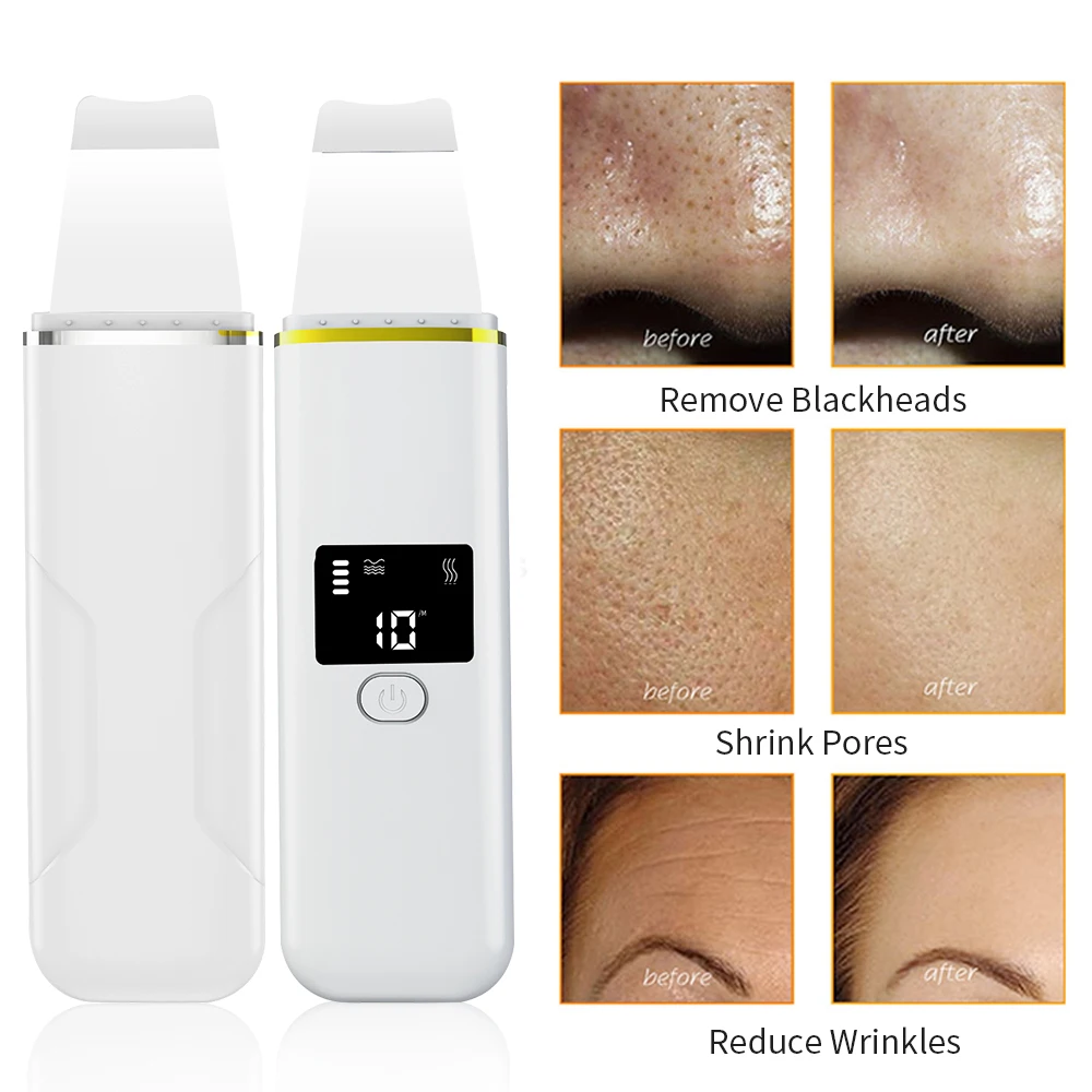 Facial Ultrasonic Skin Scrubber Blackhead Remover Skin Spatula Face Gentle Scraper Lifting Peel Pore Clean Comedones Extractor
Facial Ultrasonic Skin Scrubber Blackhead Remover Skin Spatula Face Gentle Scraper Lifting Peel Pore Clean Comedones Extractor