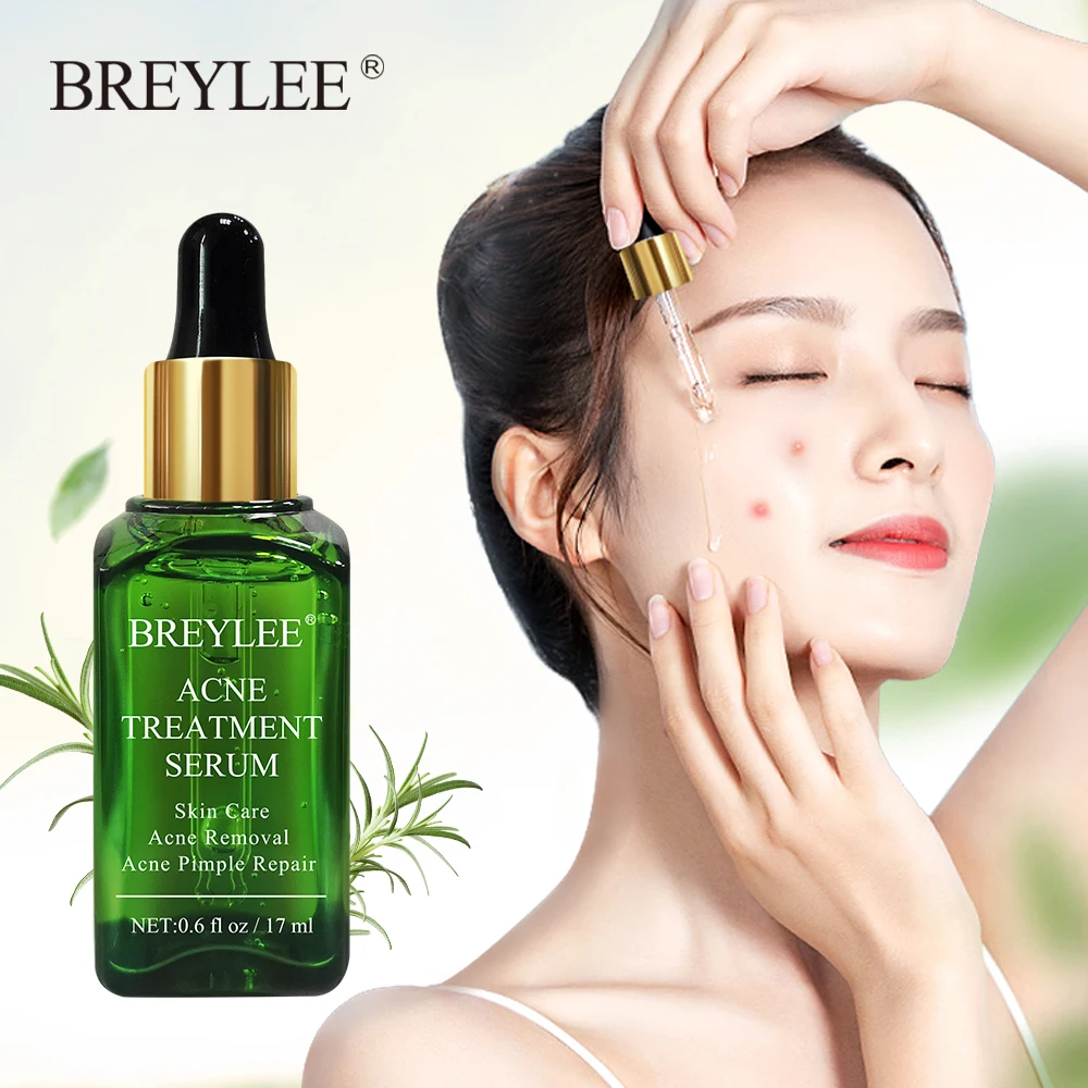 BREYLEE Acne Treatment Face Serum Mask Anti Acne Pimple Scar Remover Moisturizing Whitening Skin Care Facial Essence Cream 17ml
BREYLEE Acne Treatment Face Serum Mask Anti Acne Pimple Scar Remover Moisturizing Whitening Skin Care Facial Essence Cream 17ml