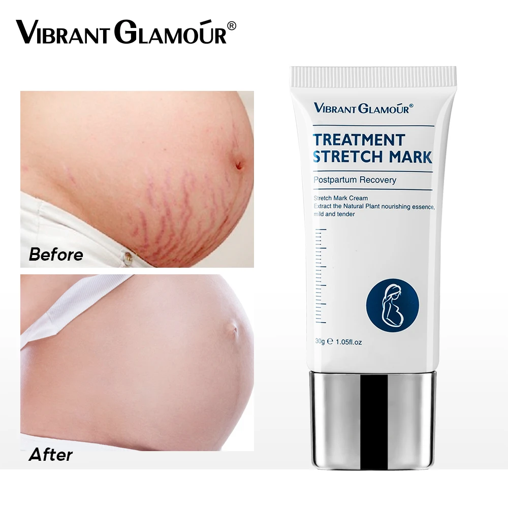 Stretch Cream Stretch Mark Removal Acne Scar Stretch Fat Striae Gravidarum Treatment Repair Anti Aging Winkles Firming Body Care
Stretch Cream Stretch Mark Removal Acne Scar Stretch Fat Striae Gravidarum Treatment Repair Anti Aging Winkles Firming Body Care