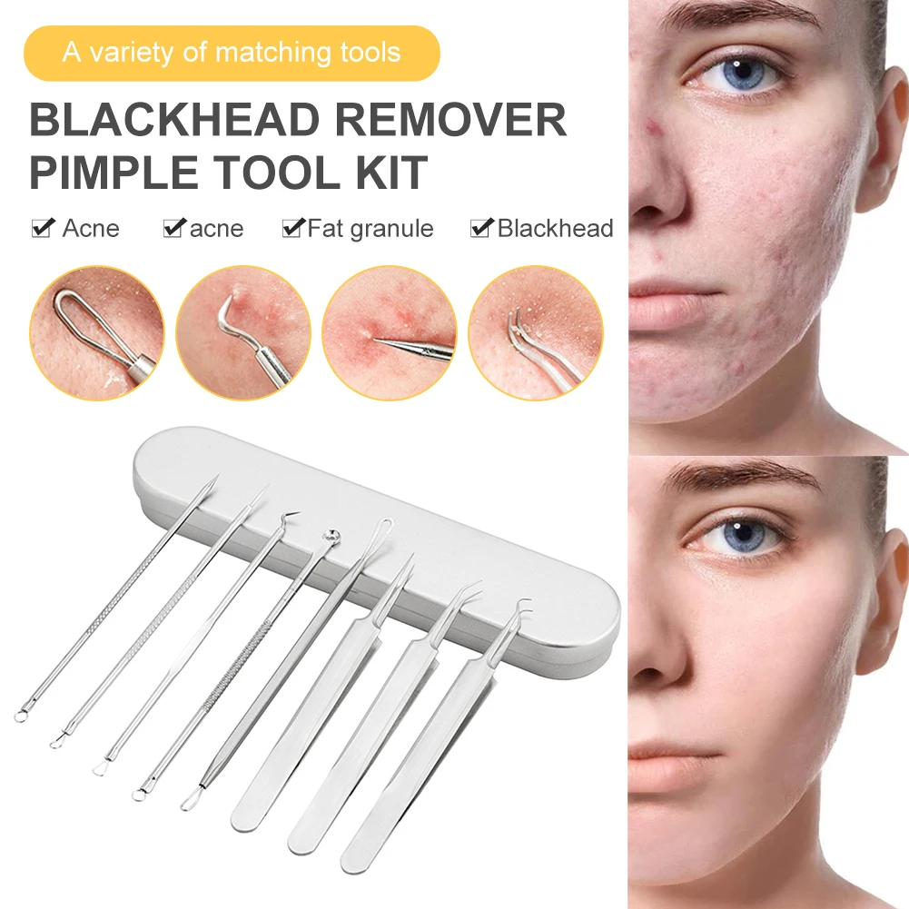 Blackhead Remover Pimple Tool Kit Stainless Steel Acne Blackhead Whitehead Comedone Extractor Tool for Nose Face Fast Delivery
Blackhead Remover Pimple Tool Kit Stainless Steel Acne Blackhead Whitehead Comedone Extractor Tool for Nose Face Fast Delivery