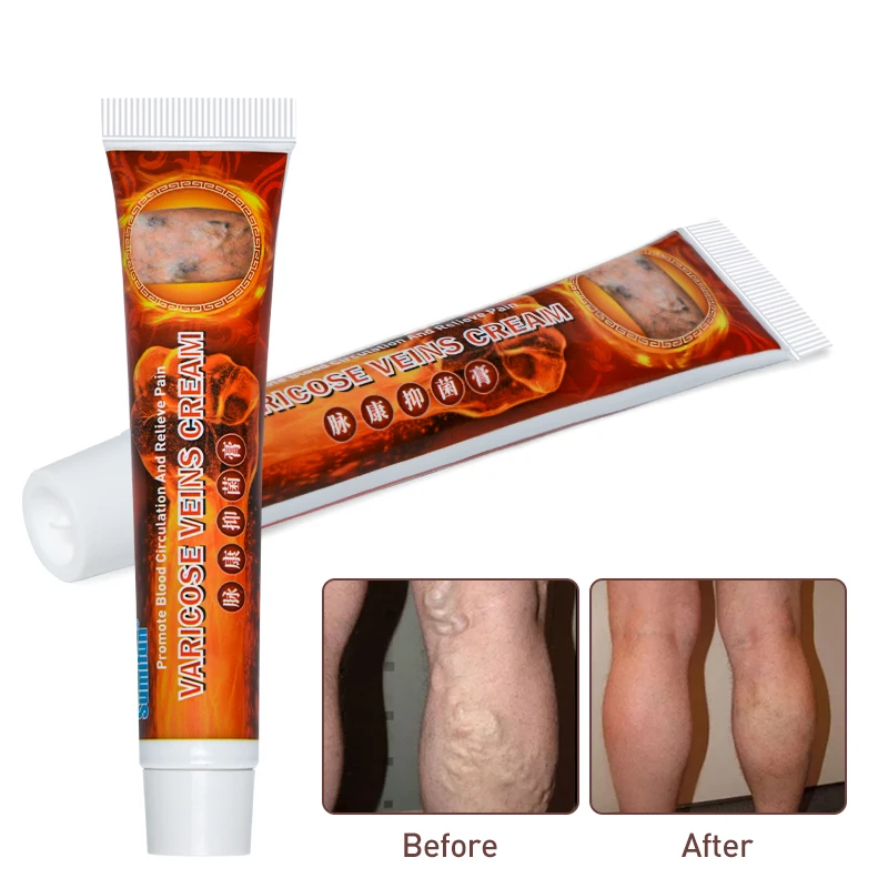 2020 100% Original New Varicose Veins Treatment Cream Vasculitis Phlebitis Spider Pain Relief Ointment Medical Plaster QC13
2020 100% Original New Varicose Veins Treatment Cream Vasculitis Phlebitis Spider Pain Relief Ointment Medical Plaster QC13