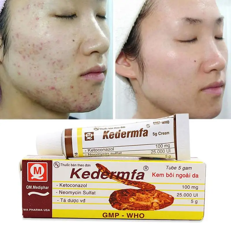 vietnam Scar Remove Cream Acne Spots Remove Striae Pigmentation Moisturizing Corrector Gravidarum V6U7
vietnam Scar Remove Cream Acne Spots Remove Striae Pigmentation Moisturizing Corrector Gravidarum V6U7