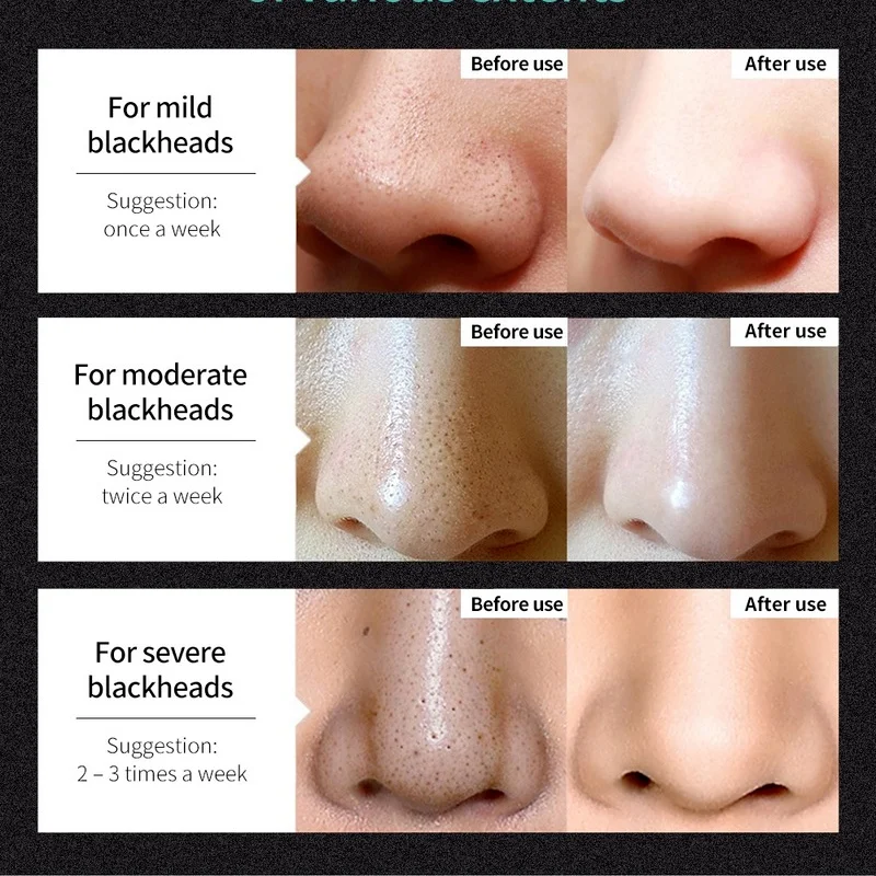 Black Mask Blackhead Makeup Remover Nose Facial Care Mud Acne Treatment Peeling Mask Pore Exfoliation Oil Control Skin Care 
Black Mask Blackhead Makeup Remover Nose Facial Care Mud Acne Treatment Peeling Mask Pore Exfoliation Oil Control Skin Care