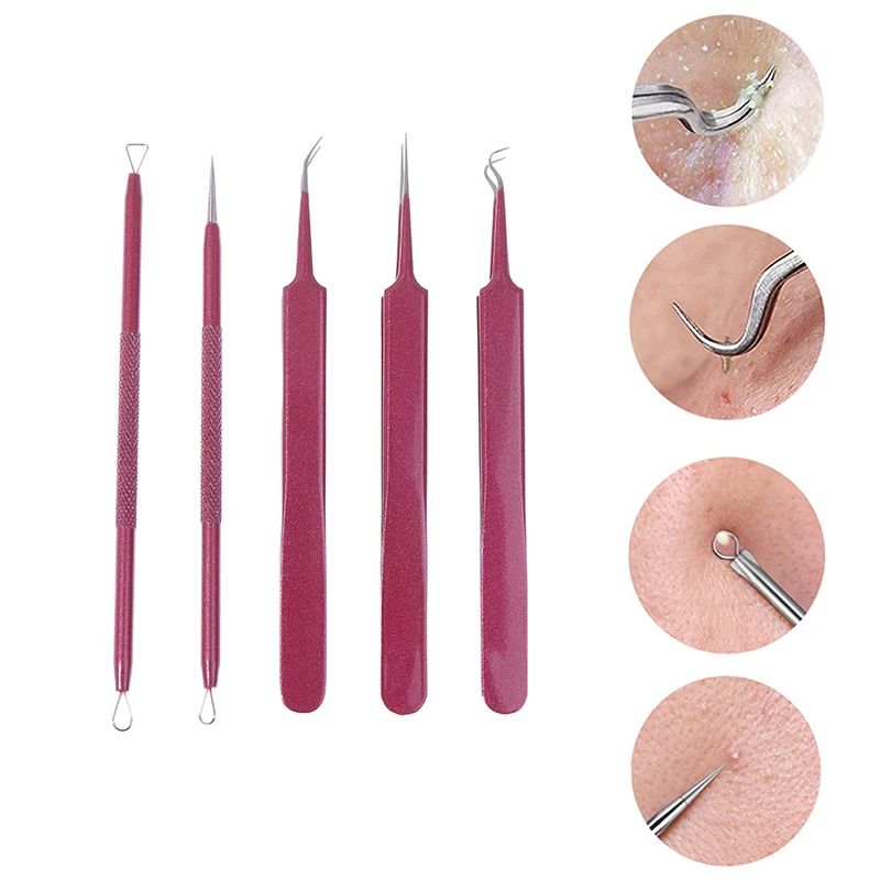 Blackhead Removal Needles Tweezers Black Dots Cleaner Pimple Spot Extractor Acne Treatment Needle Beauty Face Clean Care Tool
Blackhead Removal Needles Tweezers Black Dots Cleaner Pimple Spot Extractor Acne Treatment Needle Beauty Face Clean Care Tool