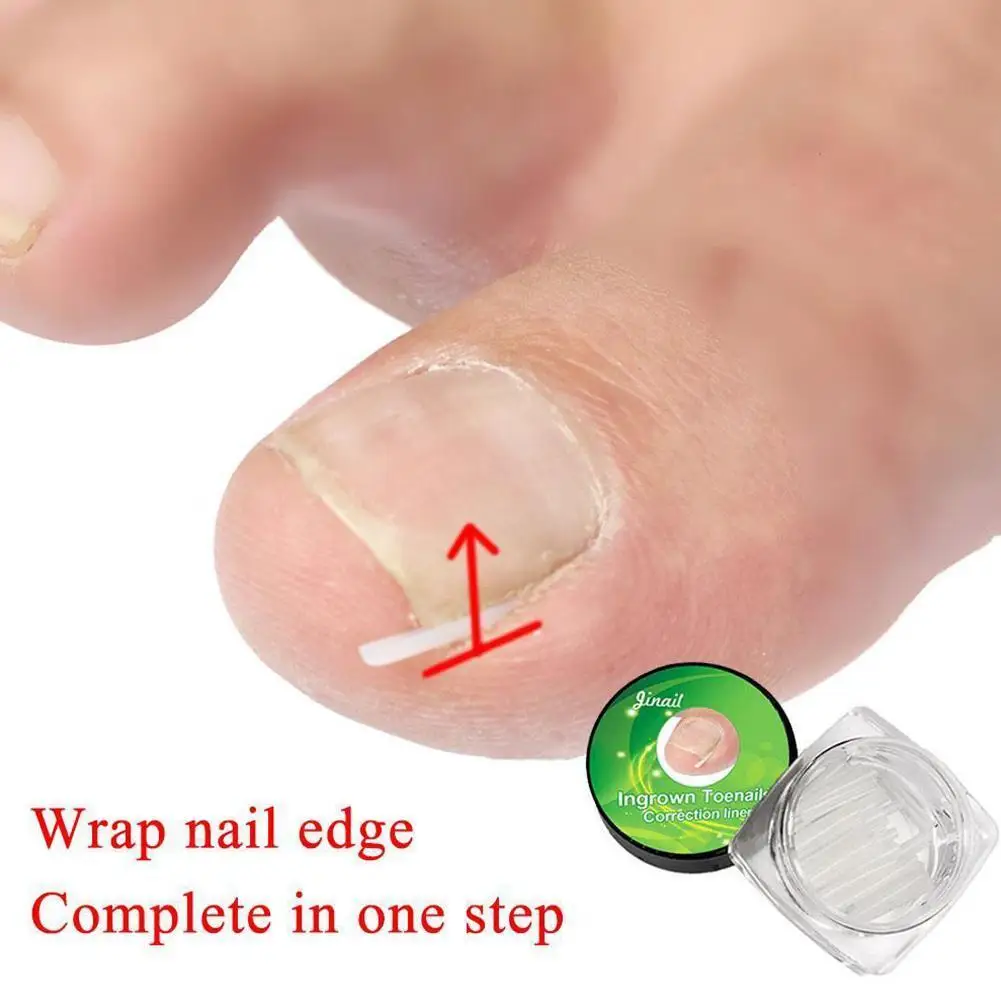 10/12pcs Silicone Ingrown Nail Pad Foot Care Nail Groove Nail Ingrown Relief Tool Corrector Correction Pad Paronychia Pain O0F7
10/12pcs Silicone Ingrown Nail Pad Foot Care Nail Groove Nail Ingrown Relief Tool Corrector Correction Pad Paronychia Pain O0F7