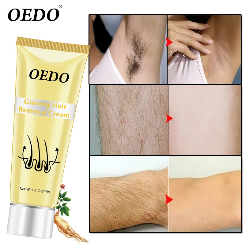 Body Hair Removal Cream Hand Leg Hair Loss Depilatory Clear Pore Dirt Armpit Mild And Not Irritating Care Effect Hair Removal
Body Hair Removal Cream Hand Leg Hair Loss Depilatory Clear Pore Dirt Armpit Mild And Not Irritating Care Effect Hair Removal