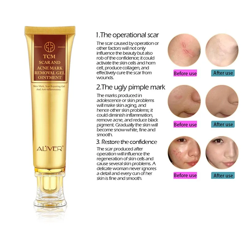Scar Removal Cream Skin Repair Face Cream Blemishes Treatment Whitening Skin Care
Scar Removal Cream Skin Repair Face Cream Blemishes Treatment Whitening Skin Care
