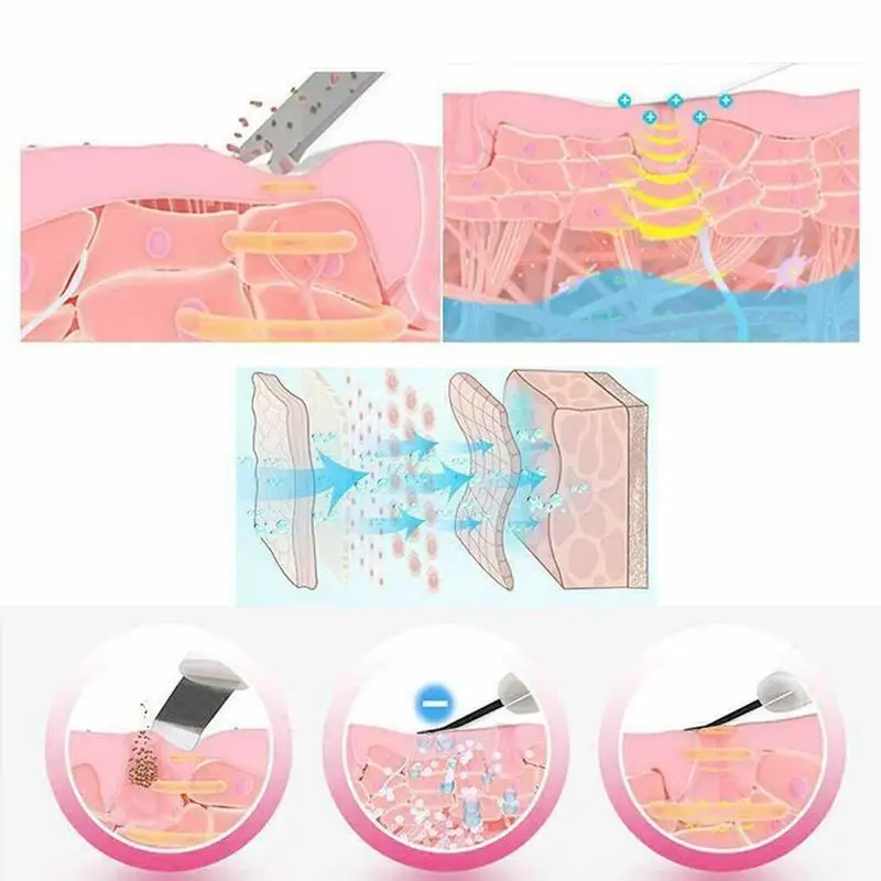 ultrasonic deep skin scrubber cleansing machine skin cleaner machine scrubber lift pore peeling shovel C6H3
ultrasonic deep skin scrubber cleansing machine skin cleaner machine scrubber lift pore peeling shovel C6H3