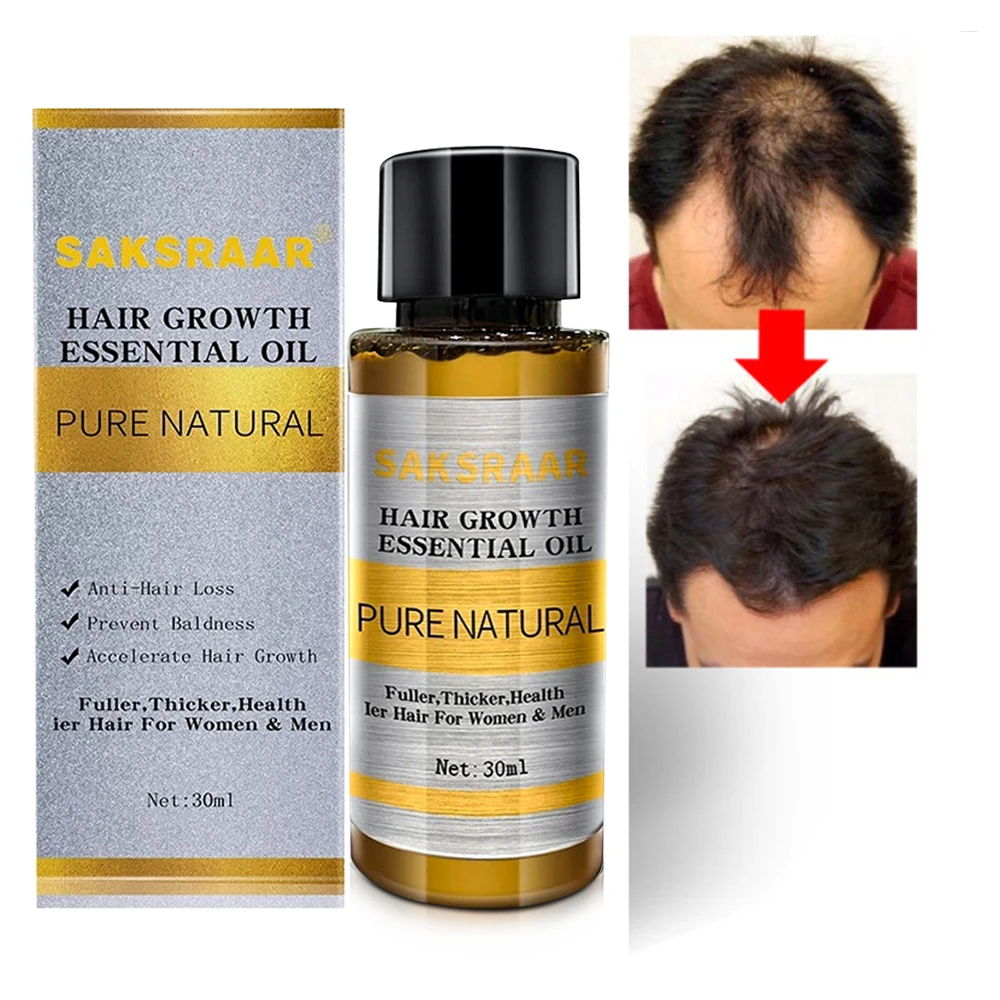 Hair Care Hair Growth Essential Oils Essence Original Authentic Hair Loss Liquid Health Care Beauty Dense Hair Growth Serum
Hair Care Hair Growth Essential Oils Essence Original Authentic Hair Loss Liquid Health Care Beauty Dense Hair Growth Serum