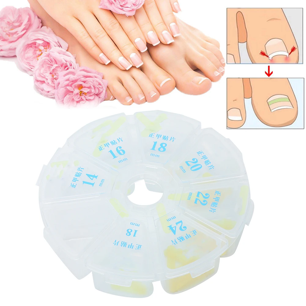 70Pcs / Box Toenail Correction Stickers Correct Ingrown Toenail Reduction Pain Redness Restore Health Foot Care Pedicure Sticker
70Pcs / Box Toenail Correction Stickers Correct Ingrown Toenail Reduction Pain Redness Restore Health Foot Care Pedicure Sticker