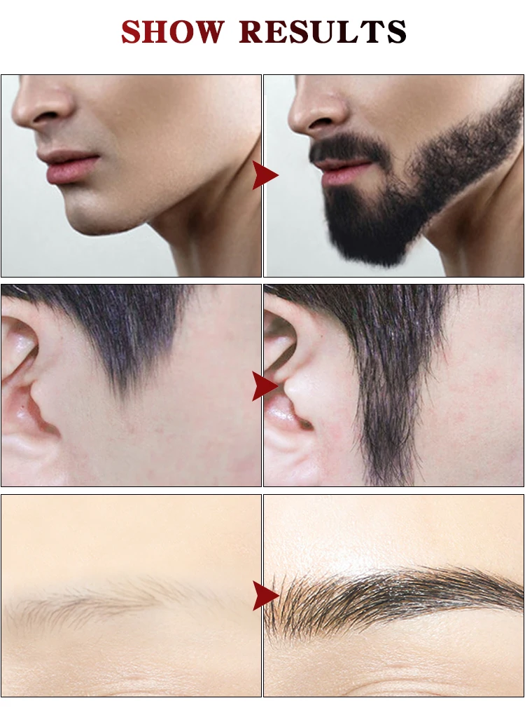 Men's Plant Dense Tough Beard Care Cream Moisturizing Smooth Promote Growth Lubrication Cream Beard Care Cream
Men's Plant Dense Tough Beard Care Cream Moisturizing Smooth Promote Growth Lubrication Cream Beard Care Cream