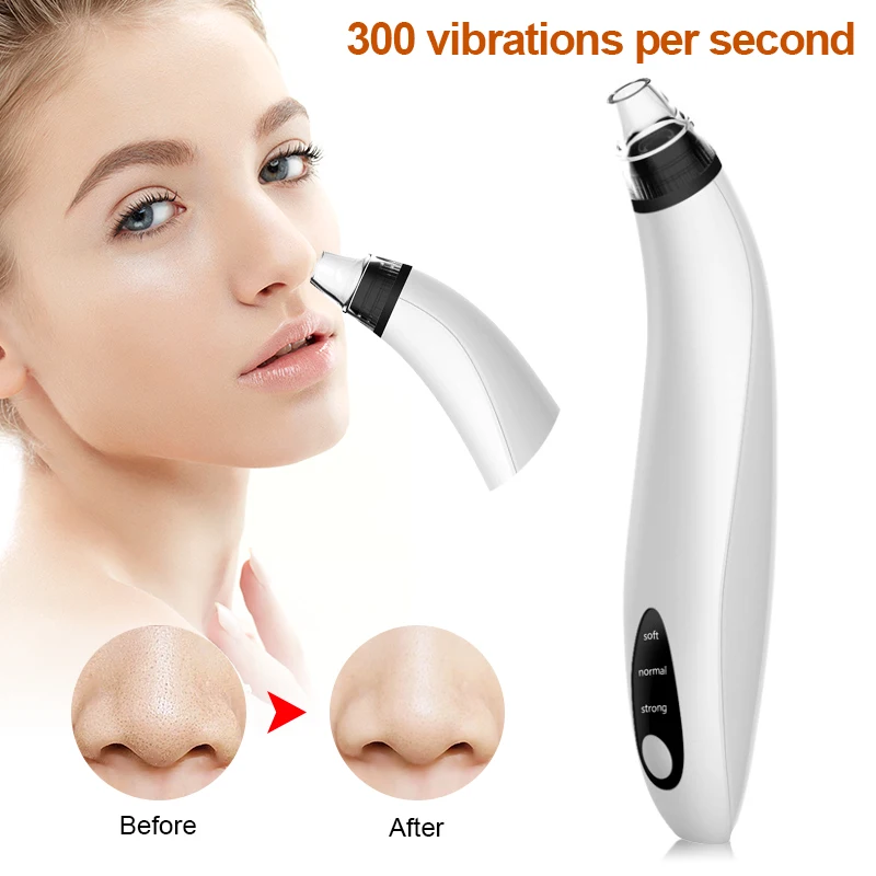 Blackhead Remover Electric Acne Cleaner Blackhead Black Point Vacuum Cleaner Tool Black Spots Pore Cleaner Machine 2022 New
Blackhead Remover Electric Acne Cleaner Blackhead Black Point Vacuum Cleaner Tool Black Spots Pore Cleaner Machine 2022 New