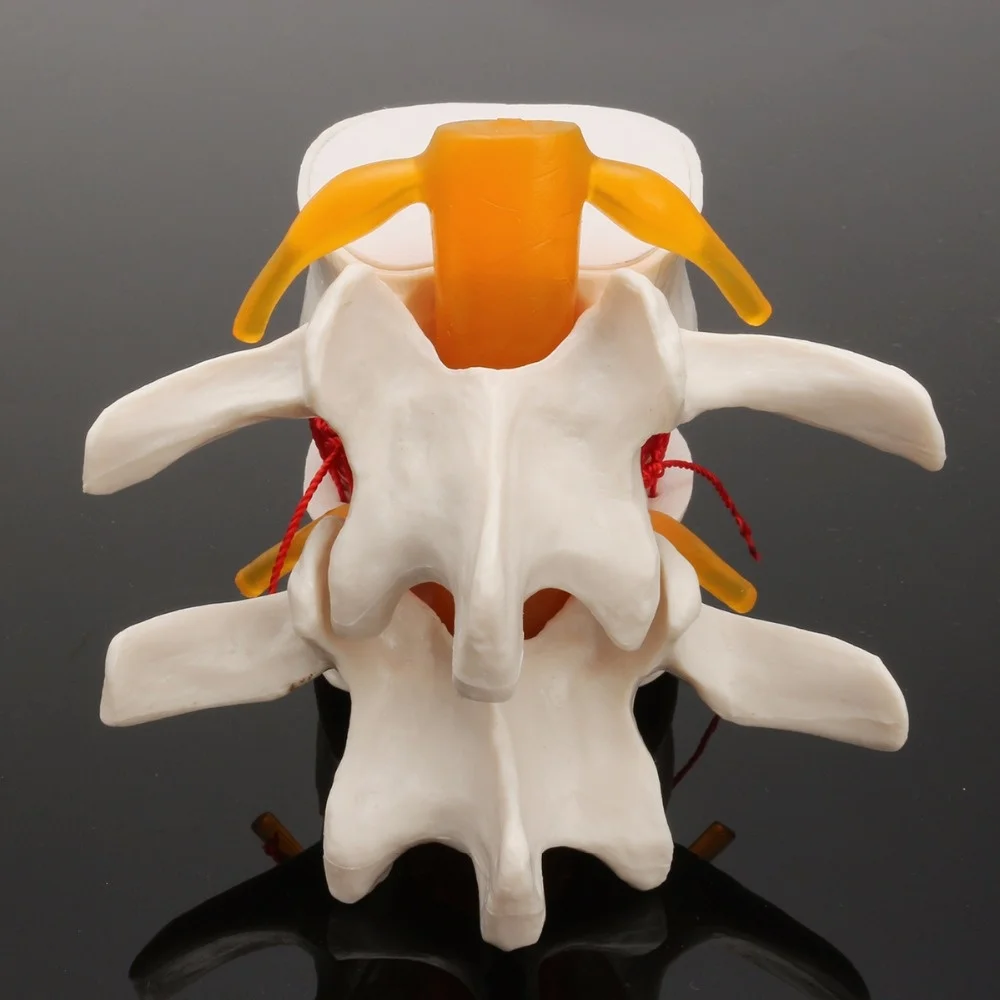 Spine skeleton Human anatomy Lumbar Disc Herniation Teaching Model brain skull traumatic pistol school supplies medical instrume
Spine skeleton Human anatomy Lumbar Disc Herniation Teaching Model brain skull traumatic pistol school supplies medical instrume