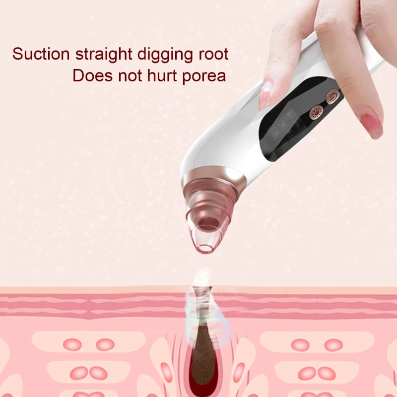 Blackhead Remover Vacuum Electric Acne Comedone Extractor Facial Pore Cleanser C1FF
Blackhead Remover Vacuum Electric Acne Comedone Extractor Facial Pore Cleanser C1FF