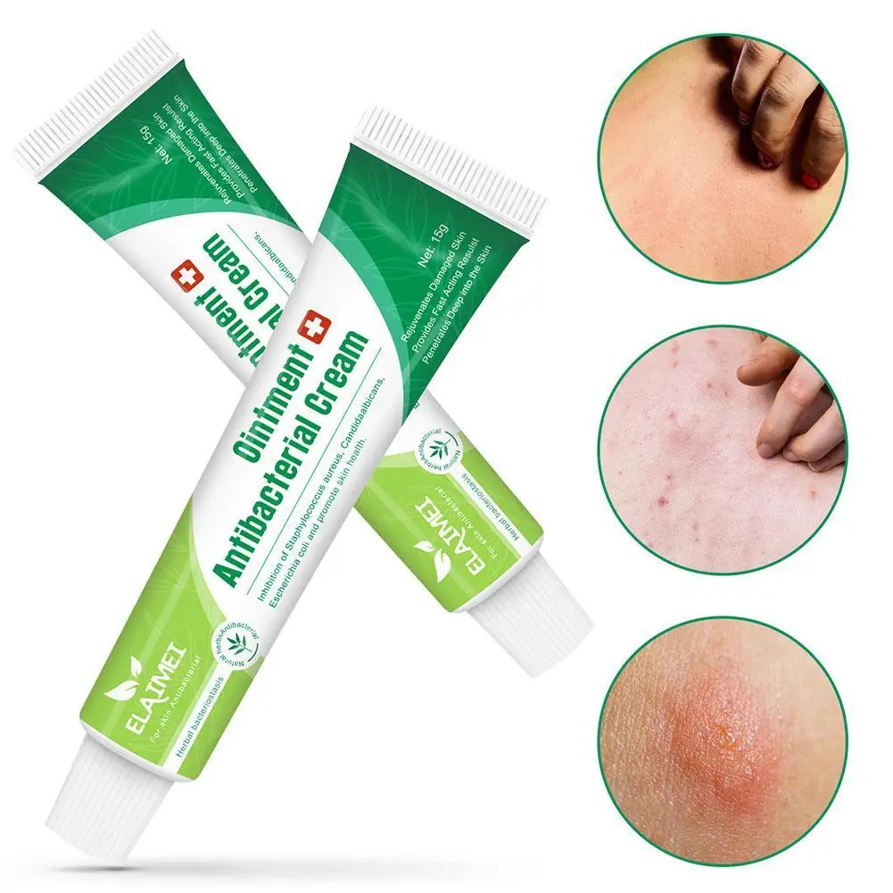 15g Herbal Antibacterial Ointment For Mosquito Bites Relieve To Topical Itching Skin Itching And Cream Z8K8
15g Herbal Antibacterial Ointment For Mosquito Bites Relieve To Topical Itching Skin Itching And Cream Z8K8