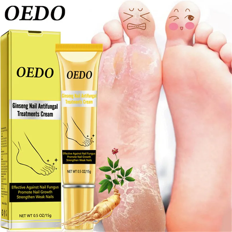 Ginseng Nail Antifungal Treatments Cream Herbal Removal Nail Fungus Gel Anti Infection Paronychia Onychomycosis Toe Foot Care
Ginseng Nail Antifungal Treatments Cream Herbal Removal Nail Fungus Gel Anti Infection Paronychia Onychomycosis Toe Foot Care