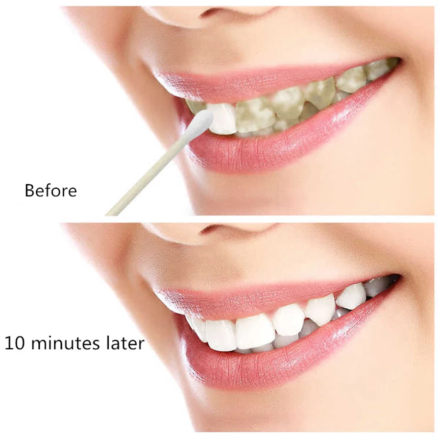 Teeth Whitening Serum Gel Dental Oral Hygiene Effective Remove Stains Plaque Teeth Cleaning Essence Dental Care Toothpaste
Teeth Whitening Serum Gel Dental Oral Hygiene Effective Remove Stains Plaque Teeth Cleaning Essence Dental Care Toothpaste