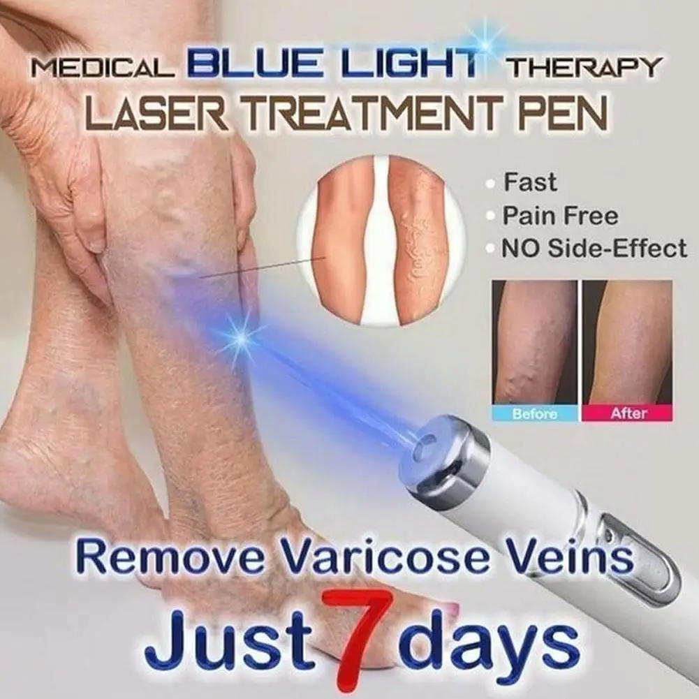 Hot Heath Blue Light Therapy Varicose Veins Treatment Removal Wrinkle Pen Massage Soft Acne Scar Treatment Pen Relax C3Z9
Hot Heath Blue Light Therapy Varicose Veins Treatment Removal Wrinkle Pen Massage Soft Acne Scar Treatment Pen Relax C3Z9