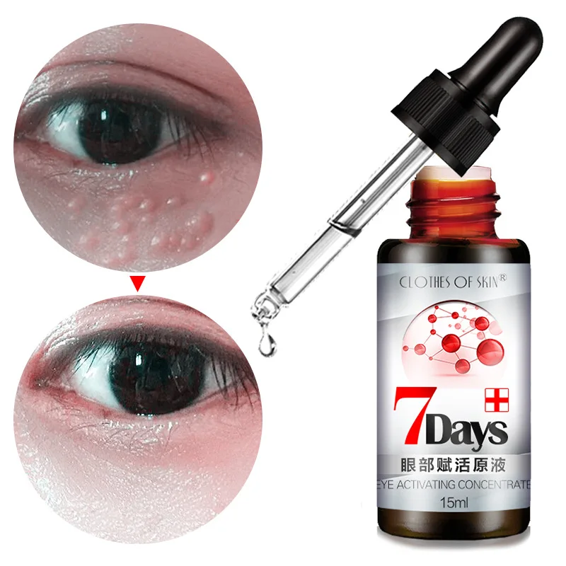 Skin Chlamydia Eye Essence Removal of fat particles, diminishing dark circles and bags under the eyes
Skin Chlamydia Eye Essence Removal of fat particles, diminishing dark circles and bags under the eyes