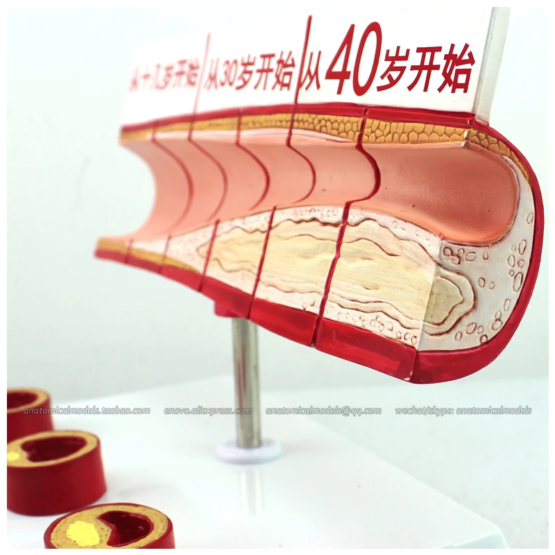 12484 / Artery w Plaque Buildup Anatomy Study Model, Medical Science Educational Teaching Anatomical Models
12484 / Artery w Plaque Buildup Anatomy Study Model, Medical Science Educational Teaching Anatomical Models