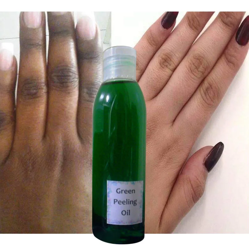 Green peeling oil for mami blemish stain Reduce stretch marks acne scars hyperpigmentation age-related stains Whitening 50-100ml
Green peeling oil for mami blemish stain Reduce stretch marks acne scars hyperpigmentation age-related stains Whitening 50-100ml