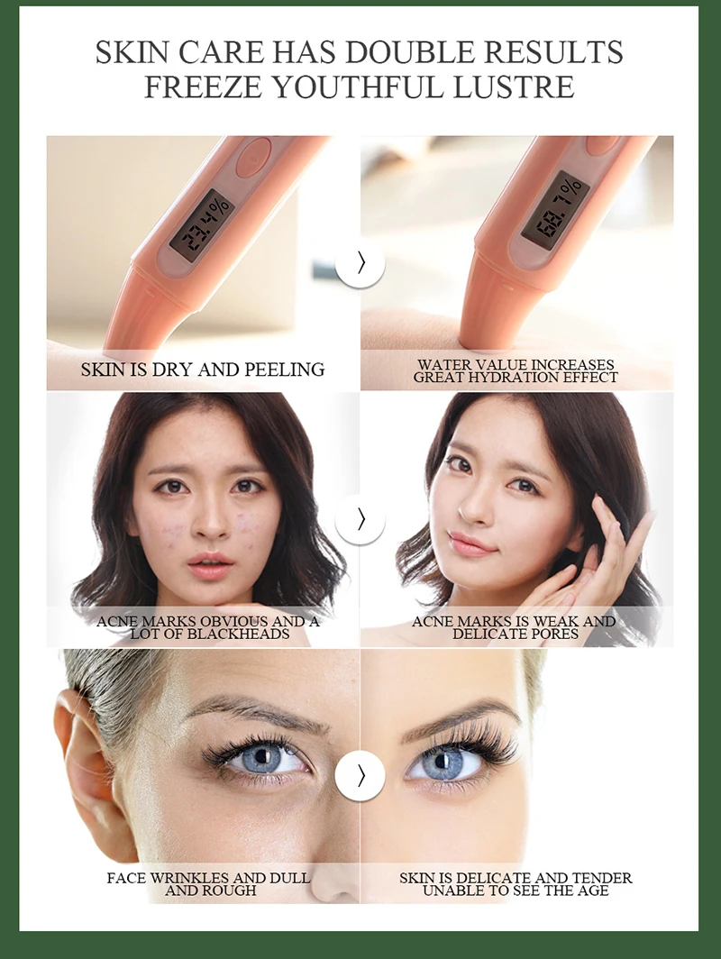 MELAO Snail Face Cream Acne Scar Removal Cream Whitening Snail Stretch Marks Oil-control Repiring Cream For Face Skin Care TSLM2
MELAO Snail Face Cream Acne Scar Removal Cream Whitening Snail Stretch Marks Oil-control Repiring Cream For Face Skin Care TSLM2
