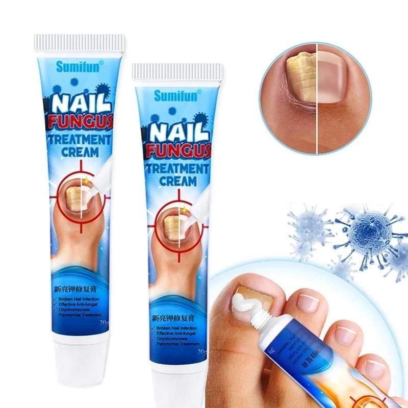 5pcs Nail Fungus Removal Cream Onychomycosis Fungal Nail Treatment Paronychia Anti Infection Feet Toe Fungal Nail Care Ointment
5pcs Nail Fungus Removal Cream Onychomycosis Fungal Nail Treatment Paronychia Anti Infection Feet Toe Fungal Nail Care Ointment