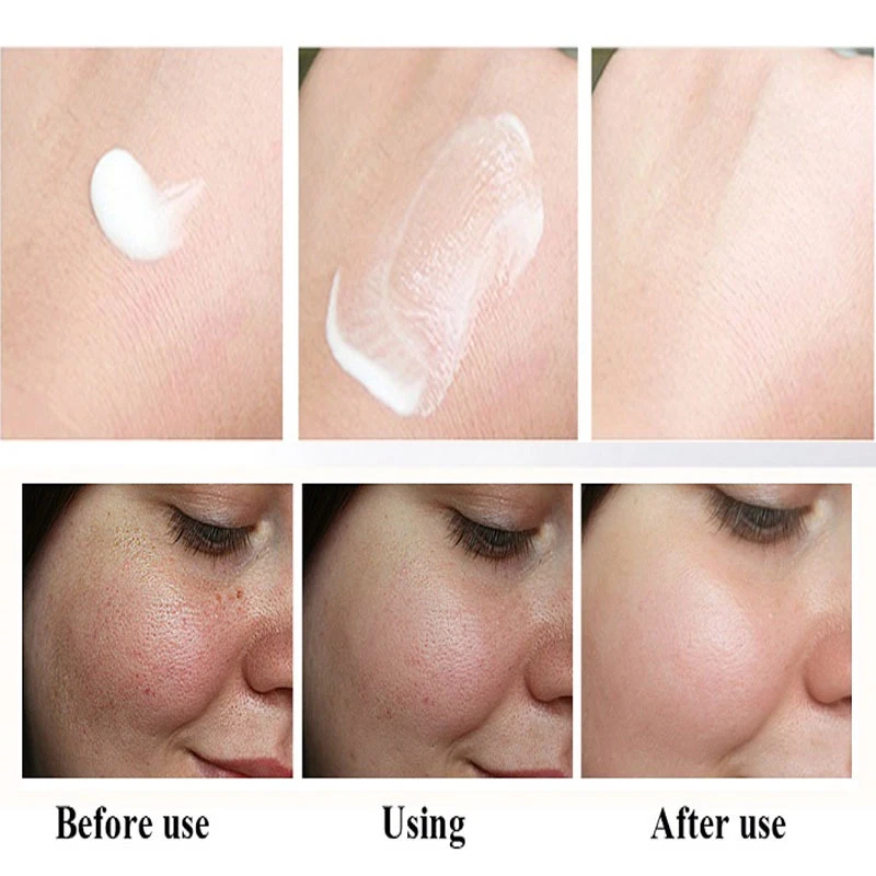 VOVA Whitening Freckle Cream Remove Melasma Acne Spot Pigment Melanin Dark Spots Pigmentation Moisturizing Gel Skin Care TSLM1
VOVA Whitening Freckle Cream Remove Melasma Acne Spot Pigment Melanin Dark Spots Pigmentation Moisturizing Gel Skin Care TSLM1