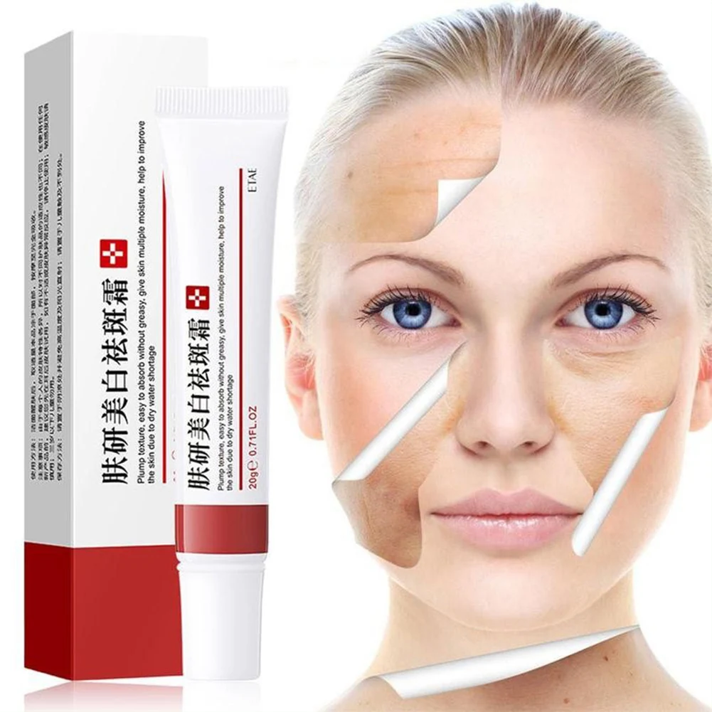 Freckle Removal Cream Acne Cream Acne Treatment Face Cream Shrink Pores Control Acne Cream Whitening Moisturizing Oil Skin Care
Freckle Removal Cream Acne Cream Acne Treatment Face Cream Shrink Pores Control Acne Cream Whitening Moisturizing Oil Skin Care
