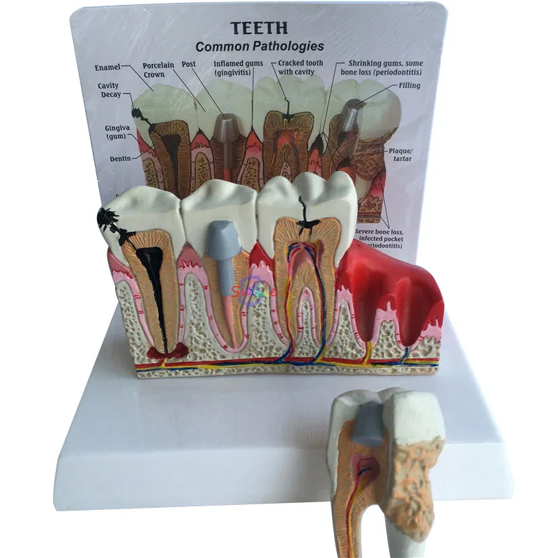 Dental Teeth Anatomical Model Dental Anatomy Teeth Model Oversized Anatomy Standard Dentist student Model for Teaching
Dental Teeth Anatomical Model Dental Anatomy Teeth Model Oversized Anatomy Standard Dentist student Model for Teaching