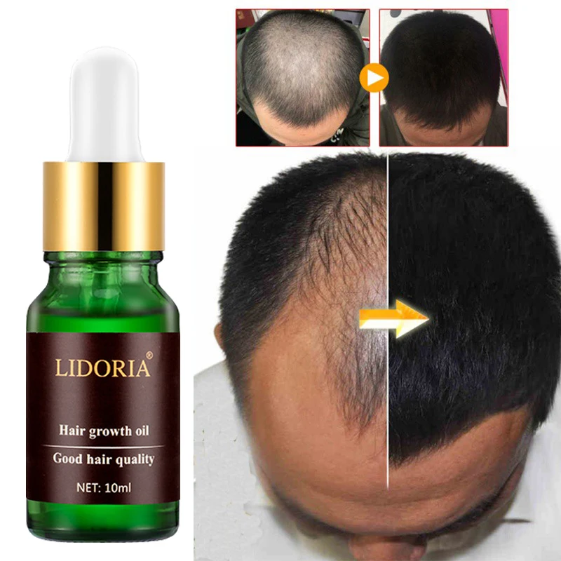 Effective Hair Growth Essential Oil Anti-Hair Loss Product Nourish Hair Roots Serum Repair Dry Frizzy Damage Thinning Scalp Care
Effective Hair Growth Essential Oil Anti-Hair Loss Product Nourish Hair Roots Serum Repair Dry Frizzy Damage Thinning Scalp Care