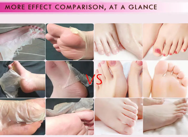 New 1pair Mango soft nourishing foot mask Foot Peeling Renewal Mask Remove Dead Skin Cuticles Heel Quick results Nourished Care
New 1pair Mango soft nourishing foot mask Foot Peeling Renewal Mask Remove Dead Skin Cuticles Heel Quick results Nourished Care