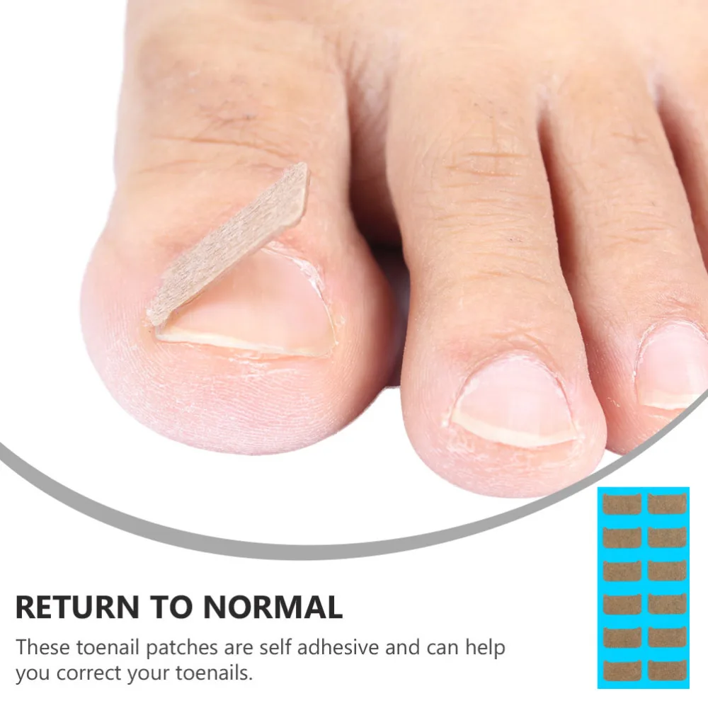 36Pcs Toenail Corrector Stickers Tape Pedicure Care Healing Tool for Home Salon
36Pcs Toenail Corrector Stickers Tape Pedicure Care Healing Tool for Home Salon