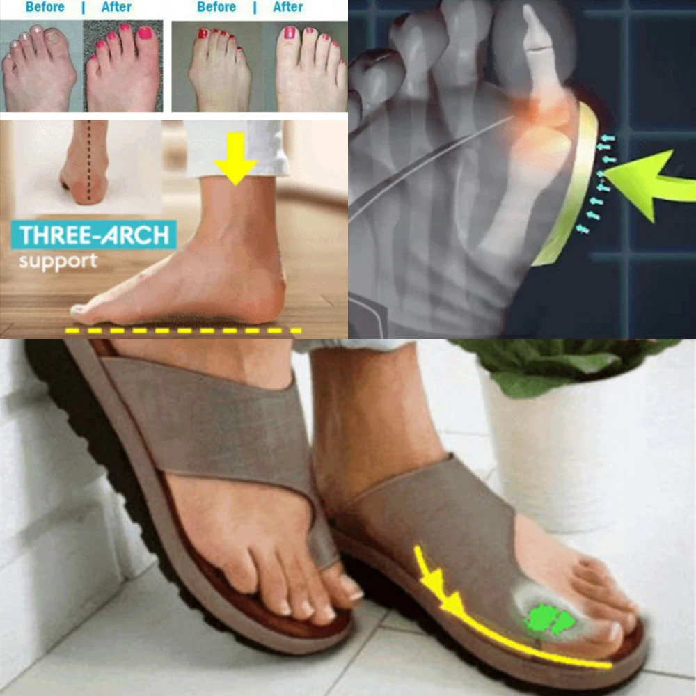 Woman Summer Wedge Slippers PU Leather Shoes Sandalias Gladiator Sandal Dropshipping Casual Big Toe Foot Correction Sandal 
Woman Summer Wedge Slippers PU Leather Shoes Sandalias Gladiator Sandal Dropshipping Casual Big Toe Foot Correction Sandal