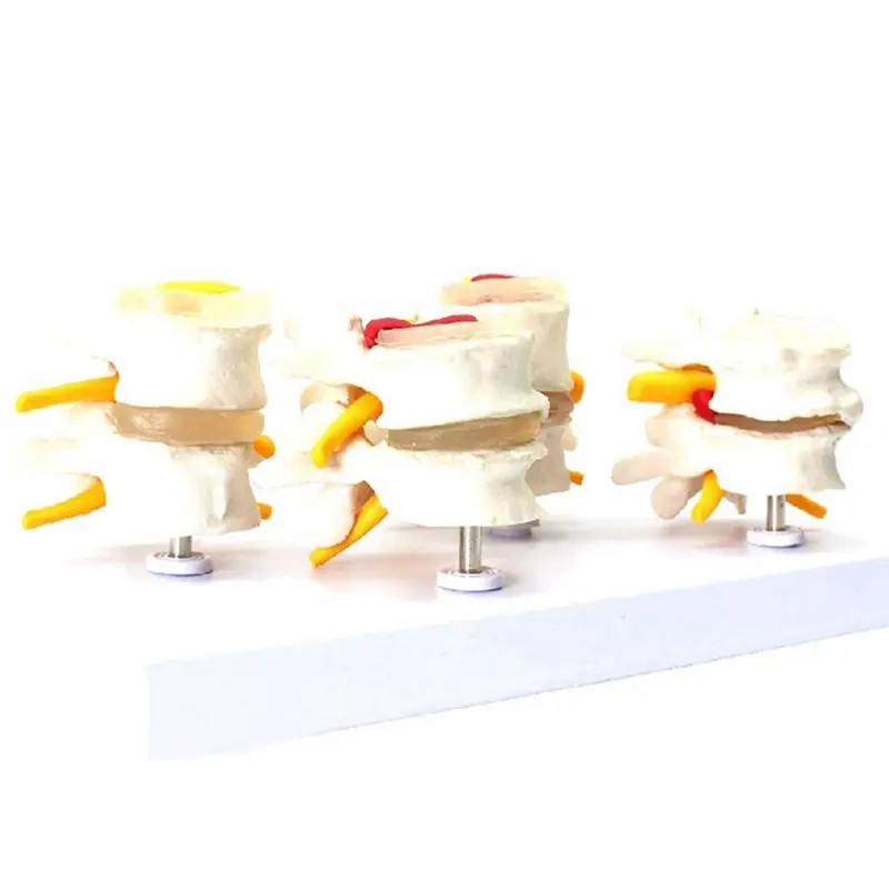 1 Pcs Human Shoulder Joint Model,Accurate Shoulder Skeleton & 1 Pcs Human Anatomy Skeleton Spine 4-Stages Supplies
1 Pcs Human Shoulder Joint Model,Accurate Shoulder Skeleton & 1 Pcs Human Anatomy Skeleton Spine 4-Stages Supplies